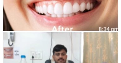 दांतो की सफाई से नही होता कमजोर कई लोगो के बीच गलतफहमियां: डॉ.नवाज. रायपुर